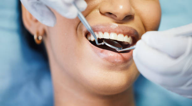 Best Emergency Root Canal Therapy in North Lakeport, CA